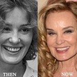 Jessica Lange before and after plastic surgery (30)
