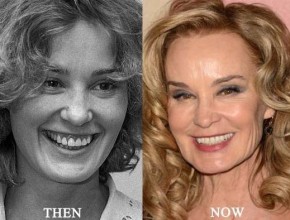 Jessica Lange before and after plastic surgery (30)