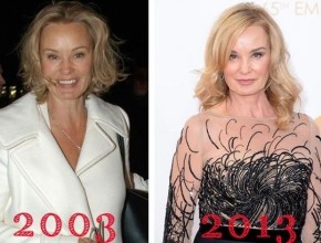 Jessica Lange then and now plastic surgery (21)