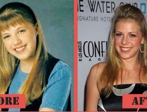 Jodie Sweetin before and after plastic surgery (30)