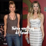 Kaley Cuoco Plastic Surgery (28)