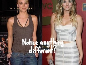 Kaley Cuoco Plastic Surgery (28)