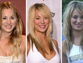 Kaley Cuoco Plastic Surgery (7)