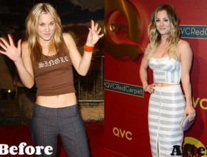 Kaley Cuoco before and after Plastic Surgery (29)