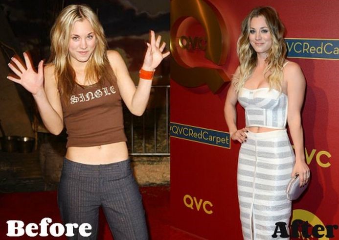 Kaley Cuoco before and after Plastic Surgery (29) .