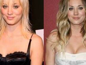 Kaley Cuoco before and after breast augmentation (1)