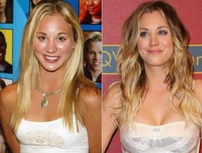 Kaley Cuoco before and after breast augmentation