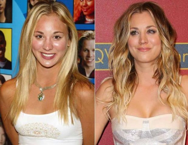 Kaley Cuoco before and after breast augmentation