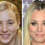 Kaley Cuoco before and after nose job