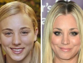 Kaley Cuoco before and after nose job