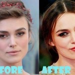 Keira Knightley Plastic Surgery (22)