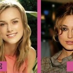 Keira Knightley Plastic Surgery (26)