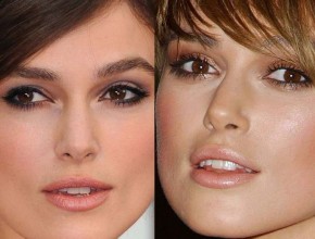 Keira Knightley before and after Plastic Surgery (23)