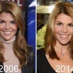 Lori Loughlin before and after plastic surgery (14)