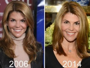 Lori Loughlin before and after plastic surgery (14)