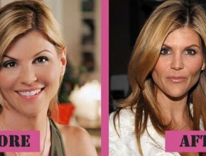 Lori Loughlin before and after plastic surgery (15)