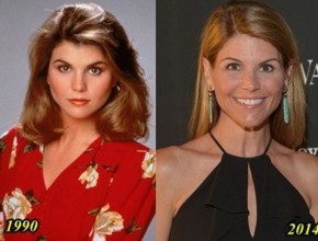Lori Loughlin before and after plastic surgery (17)