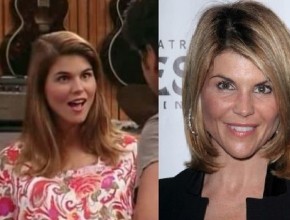 Lori Loughlin before and after plastic surgery (8)