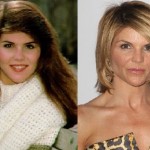 Lori Loughlin before and after plastic surgery (9)
