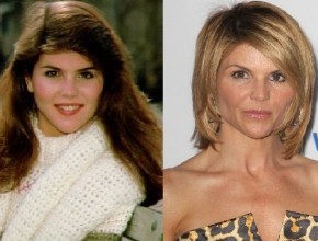 Lori Loughlin before and after plastic surgery (9)