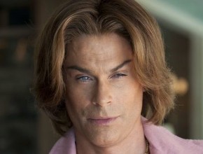 Rob Lowe after plastic surgery (1)