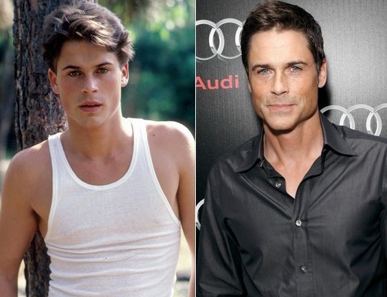 Rob Lowe before and after plastic surgery