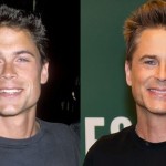 Rob Lowe before and after plastic surgery (19)