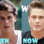 Rob Lowe before and after plastic surgery (20)