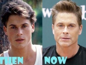 Rob Lowe before and after plastic surgery (20)