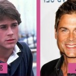 Rob Lowe before and after plastic surgery (27)