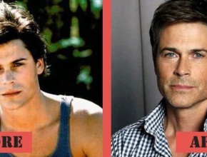 Rob Lowe before and after plastic surgery (28)