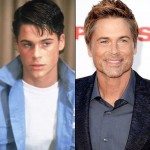 Rob Lowe before and after plastic surgery (3)