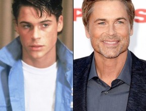 Rob Lowe before and after plastic surgery (3)