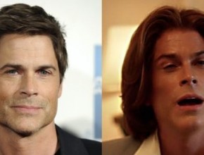 Rob Lowe before and after plastic surgery (30)