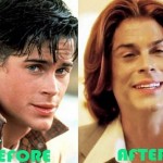 Rob Lowe before and after plastic surgery (31)