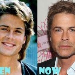 Rob Lowe before and after plastic surgery (32)