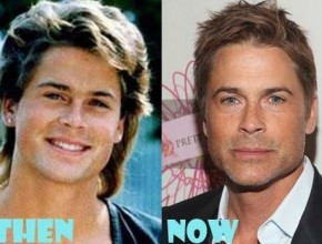 Rob Lowe before and after plastic surgery (32)