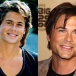 Rob Lowe before and after plastic surgery (33)