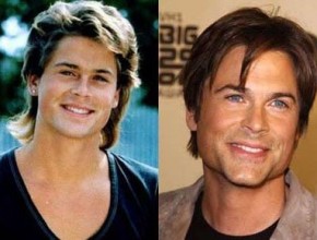Rob Lowe before and after plastic surgery (33)
