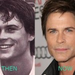 Rob Lowe plastic surgery (22)