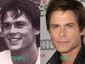 Rob Lowe plastic surgery (22)