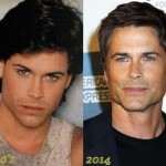 Rob Lowe plastic surgery (23)