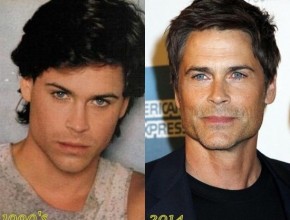 Rob Lowe plastic surgery (23)