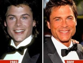 Rob Lowe plastic surgery (24)