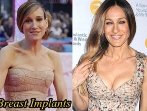 Sarah Jessica Parker before and after breast augmentation 2