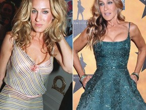 Sarah Jessica Parker before and after plastic surgery (2)