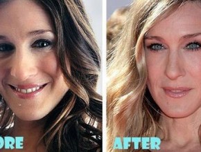 Sarah Jessica Parker before and after plastic surgery