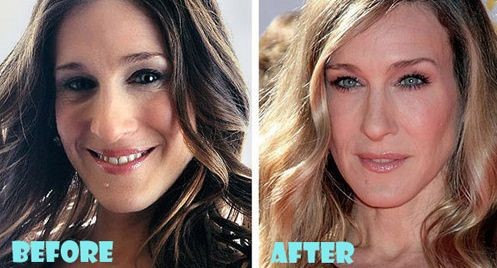 Sarah Jessica Parker before and after plastic surgery