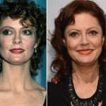 Susan Sarandon before and after plastic surgery (21)