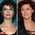 Susan Sarandon before and after plastic surgery (4)